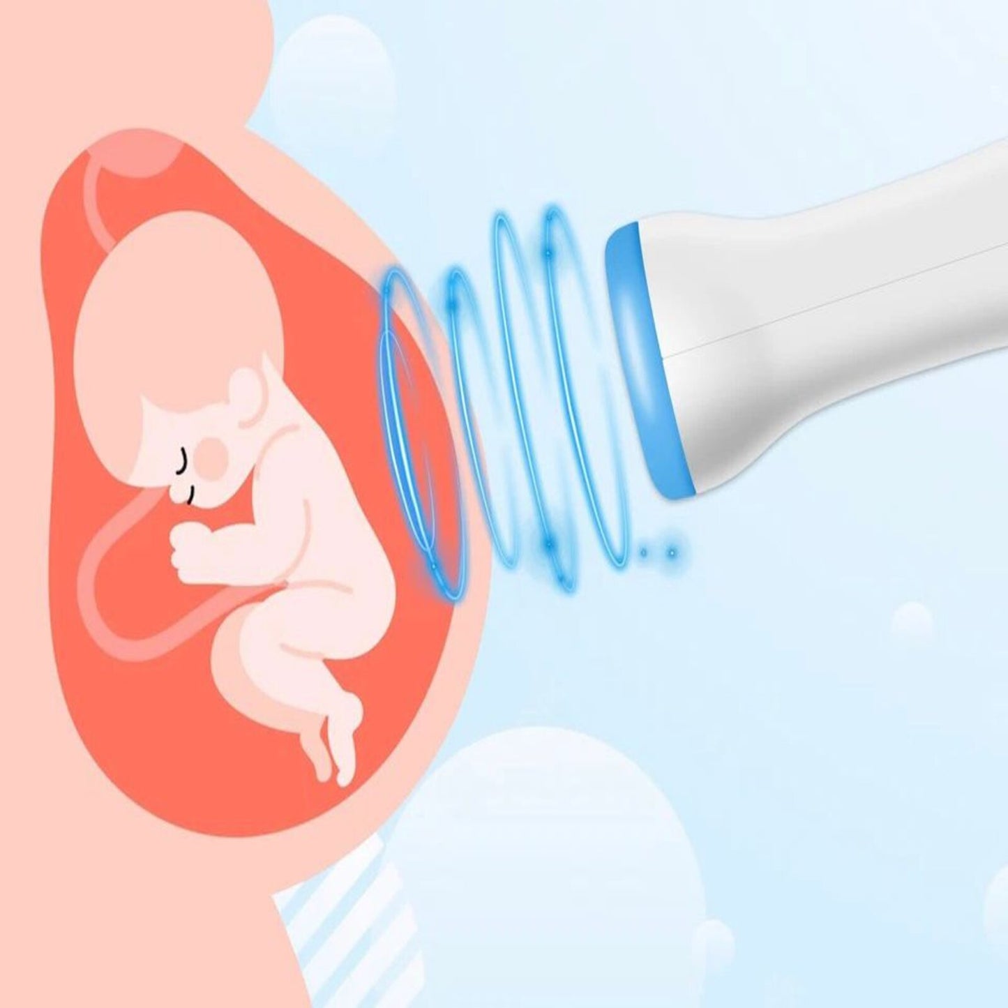 FETAL DOPPLER(BABY WATCHER) KUĆNI ULTRAZVUK ZA TRUDNICE